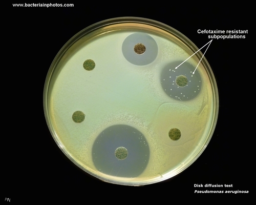 antibiotics resistant bacteria